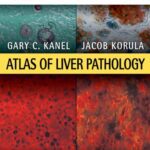 خرید و دانلود نسخه کامل کتاب Atlas of Liver Pathology