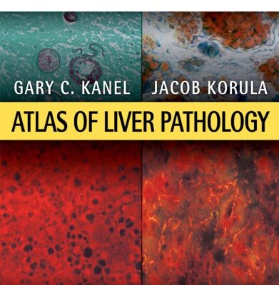 خرید و دانلود نسخه کامل کتاب Atlas of Liver Pathology