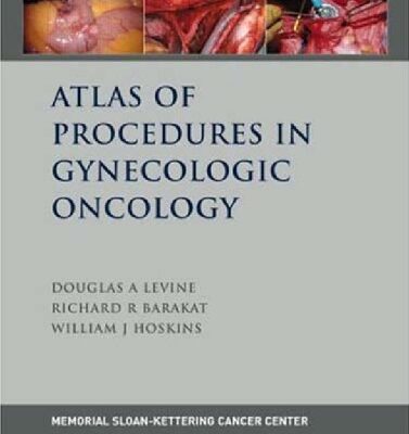 خرید و دانلود نسخه کامل کتاب Atlas of Procedures in Gynecologic Oncology