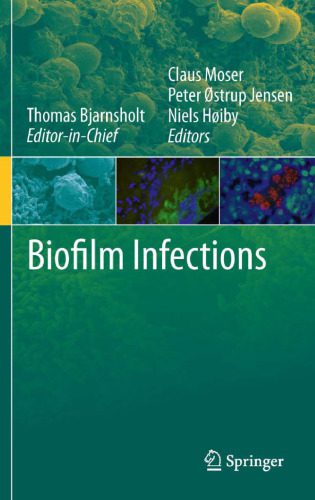 خرید و دانلود نسخه کامل کتاب Biofilm Infections_68e585e21502a.jpeg خرید و دانلود نسخه کامل کتاب Biofilm Infections