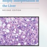 خرید و دانلود نسخه کامل کتاب Biopsy Interpretation of the Liver, Second Edition (Biopsy Interpretation Series)