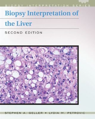 خرید و دانلود نسخه کامل کتاب Biopsy Interpretation of the Liver, Second Edition (Biopsy Interpretation Series)