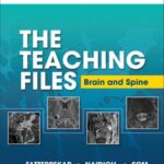 خرید و دانلود نسخه کامل کتاب Brain and Spine