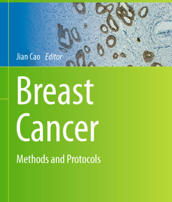 خرید و دانلود نسخه کامل کتاب Breast Cancer: Methods and Protocols