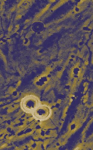 خرید و دانلود نسخه کامل کتاب Cancer Cytogenetics. Methods and Protocols_68e71694f0f80.jpeg خرید و دانلود نسخه کامل کتاب Cancer Cytogenetics. Methods and Protocols