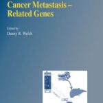 خرید و دانلود نسخه کامل کتاب Cancer Metastasis — Related Genes (CANCER METASTASIS — BIOLOGY AND TREATMENT Volume 3) (Cancer Metastasis – Biology and Treatment)
