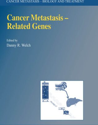 خرید و دانلود نسخه کامل کتاب Cancer Metastasis — Related Genes (CANCER METASTASIS — BIOLOGY AND TREATMENT Volume 3) (Cancer Metastasis – Biology and Treatment)