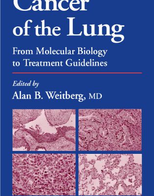 خرید و دانلود نسخه کامل کتاب Cancer of the Lung: From Molecular Biology to Treatment Guidelines (Current Clinical Oncology)