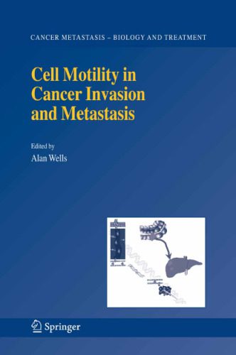 خرید و دانلود نسخه کامل کتاب Cell Motility in Cancer Invasion and Metastasis (Cancer Metastasis – Biology and Treatment)_68e8fccb9d5ec.jpeg خرید و دانلود نسخه کامل کتاب Cell Motility in Cancer Invasion and Metastasis (Cancer Metastasis – Biology and Treatment)