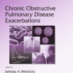 خرید و دانلود نسخه کامل کتاب Chronic Obstructive Pulmonary Disease Exacerbations (Lung Biology in Health and Disease)