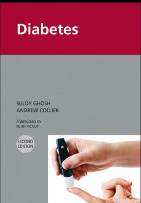 خرید و دانلود نسخه کامل کتاب Churchill’s Pocketbook of Diabetes