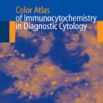 خرید و دانلود نسخه کامل کتاب Color Atlas of Immunocytochemistry in Diagnostic Cytology P Ganjei Azar M Nadji