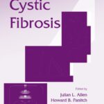 خرید و دانلود نسخه کامل کتاب Cystic Fibrosis (Lung Biology in Health and Disease)