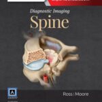 خرید و دانلود نسخه کامل کتاب Diagnostic imaging Spine