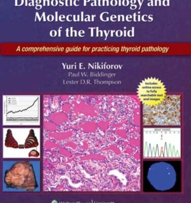 خرید و دانلود نسخه کامل کتاب Diagnostic Pathology and Molecular Genetics of the Thyroid: A Comprehensive Guide for Practicing Thyroid Pathology
