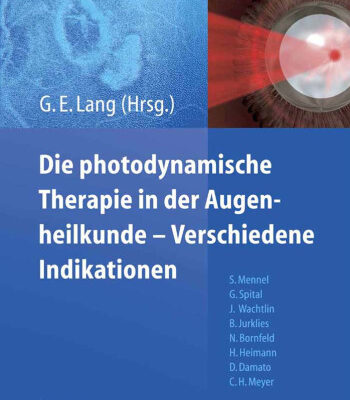 خرید و دانلود نسخه کامل کتاب Die photodynamische Therapie in der Augenheilkunde – Verschiedene Indikationen (German Edition)
