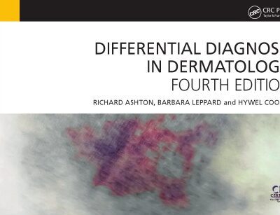 خرید و دانلود نسخه کامل کتاب Differential Diagnosis in Dermatology