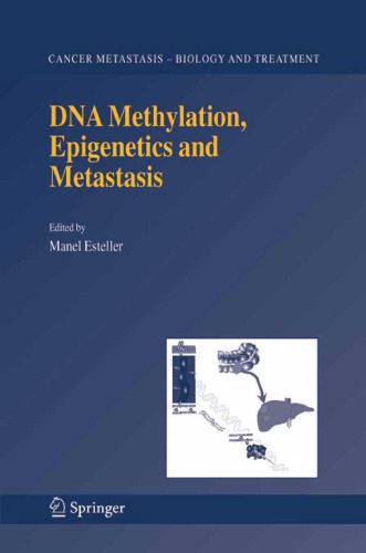 خرید و دانلود نسخه کامل کتاب DNA Methylation, Epigenetics and Metastasis (Cancer Metastasis – Biology and Treatment)_68e55caa0ec06.jpeg خرید و دانلود نسخه کامل کتاب DNA Methylation, Epigenetics and Metastasis (Cancer Metastasis – Biology and Treatment)