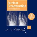خرید و دانلود نسخه کامل کتاب Forefoot Reconstruction