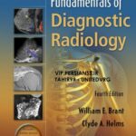 خرید و دانلود نسخه کامل کتاب Fundamentals of Diagnostic Radiology