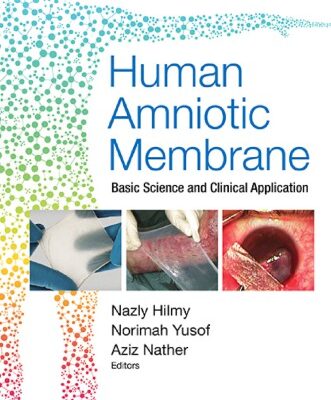 خرید و دانلود نسخه کامل کتاب Human amniotic membrane : basic science and clinical application