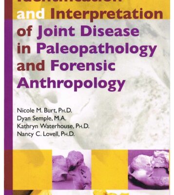 خرید و دانلود نسخه کامل کتاب Identification and interpretation of joint disease in paleopathology and forensic anthropology