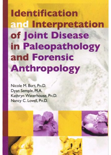خرید و دانلود نسخه کامل کتاب Identification and interpretation of joint disease in paleopathology and forensic anthropology_68e28d05e0c36.jpeg خرید و دانلود نسخه کامل کتاب Identification and interpretation of joint disease in paleopathology and forensic anthropology
