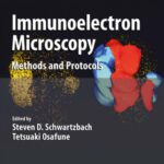 خرید و دانلود نسخه کامل کتاب Immunoelectron Microscopy: Methods and Protocols