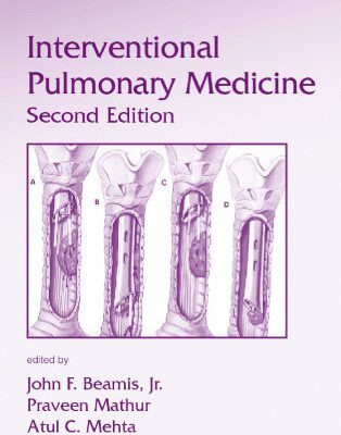 خرید و دانلود نسخه کامل کتاب Interventional Pulmonary Medicine, Second Edition, Volume 230 (Lung Biology in Health and Disease)