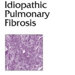 خرید و دانلود نسخه کامل کتاب Lung Biology in Health and Disease Volume 185 Idiopathic Pulmonary Fibrosis