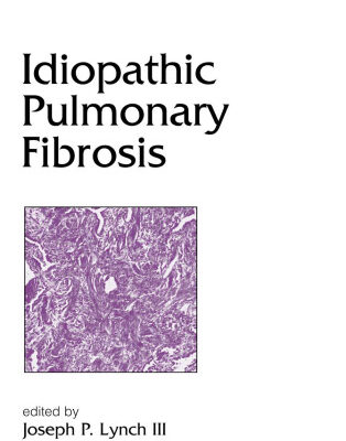 خرید و دانلود نسخه کامل کتاب Lung Biology in Health and Disease Volume 185 Idiopathic Pulmonary Fibrosis