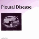 خرید و دانلود نسخه کامل کتاب Lung Biology in Health & Disease Volume 186 Pleural Disease