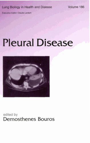 خرید و دانلود نسخه کامل کتاب Lung Biology in Health & Disease Volume 186 Pleural Disease_68e568f6da3ff.jpeg خرید و دانلود نسخه کامل کتاب Lung Biology in Health & Disease Volume 186 Pleural Disease