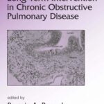 خرید و دانلود نسخه کامل کتاب Lung Biology in Health & Disease Volume 191 Long-Term Intervention in Chronic Obstructive Pulmonary Disease