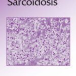 خرید و دانلود نسخه کامل کتاب Lung Biology in Health & Disease Volume 210 Sarcoidosis