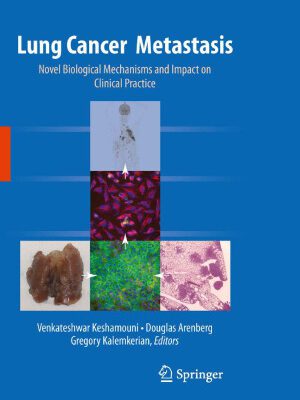 خرید و دانلود نسخه کامل کتاب Lung Cancer Metastasis: Novel Biological Mechanisms and Impact on Clinical Practice