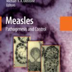 خرید و دانلود نسخه کامل کتاب Measles: Pathogenesis and Control