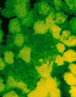 خرید و دانلود نسخه کامل کتاب Membrane Protein Protocols