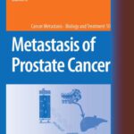 خرید و دانلود نسخه کامل کتاب Metastasis of Prostate Cancer (Cancer Metastasis – Biology and Treatment)