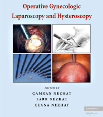 خرید و دانلود نسخه کامل کتاب Nezhat’s Operative Gynecologic Laparoscopy and Hysteroscopy