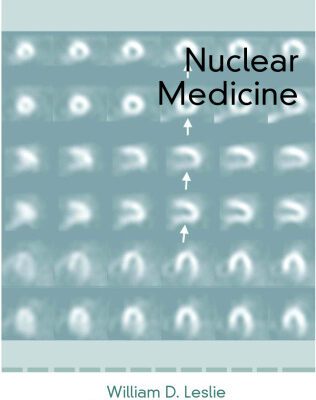 خرید و دانلود نسخه کامل کتاب Nuclear Medicine (Landes Bioscience Medical Handbook (Vademecum))