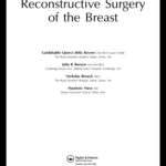خرید و دانلود نسخه کامل کتاب Oncoplastic and Reconstructive Surgery of the Breast