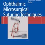 خرید و دانلود نسخه کامل کتاب Ophthalmic microsurgical suturing techniques