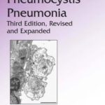 خرید و دانلود نسخه کامل کتاب Pneumocystis  Pneumonia, 3rd Edition (Lung Biology in Health and Disease)