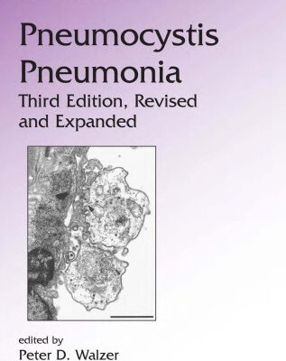 خرید و دانلود نسخه کامل کتاب Pneumocystis Pneumonia, 3rd Edition (Lung Biology in Health and Disease)