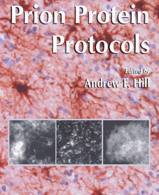 خرید و دانلود نسخه کامل کتاب Prion Protein Protocols