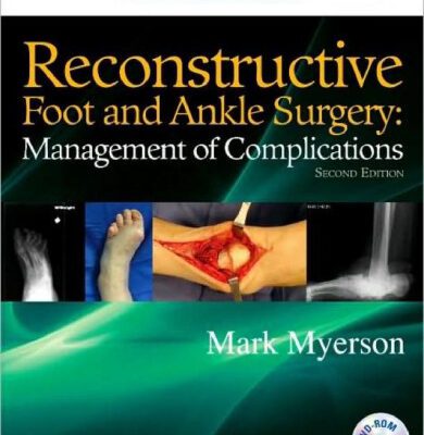 خرید و دانلود نسخه کامل کتاب Reconstructive Foot and Ankle Surgery: Management of Complications: Expert Consult – Online, Print, Second Edition