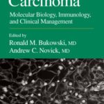 خرید و دانلود نسخه کامل کتاب Renal Cell Carcinoma: Molecular Biology, Immunology, and Clinical Management (Current clinical Oncology)