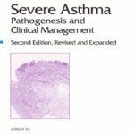 خرید و دانلود نسخه کامل کتاب Severe Asthma: Pathogenesis and Clinical Management (Lung Biology in Health and Disease)