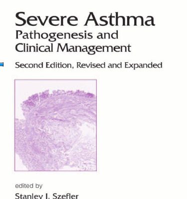 خرید و دانلود نسخه کامل کتاب Severe Asthma: Pathogenesis and Clinical Management (Lung Biology in Health and Disease)